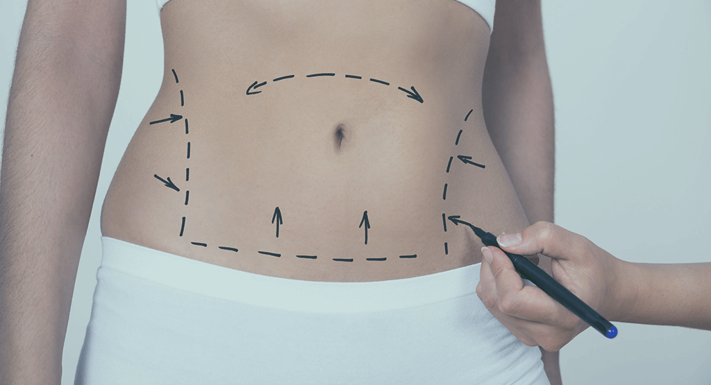 Cirurgia Plástica